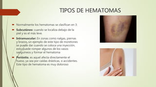Hematomas: Definición, Tipos y Datos Clave para 2023 2 hematomas definicion tipos y datos clave para 2023
