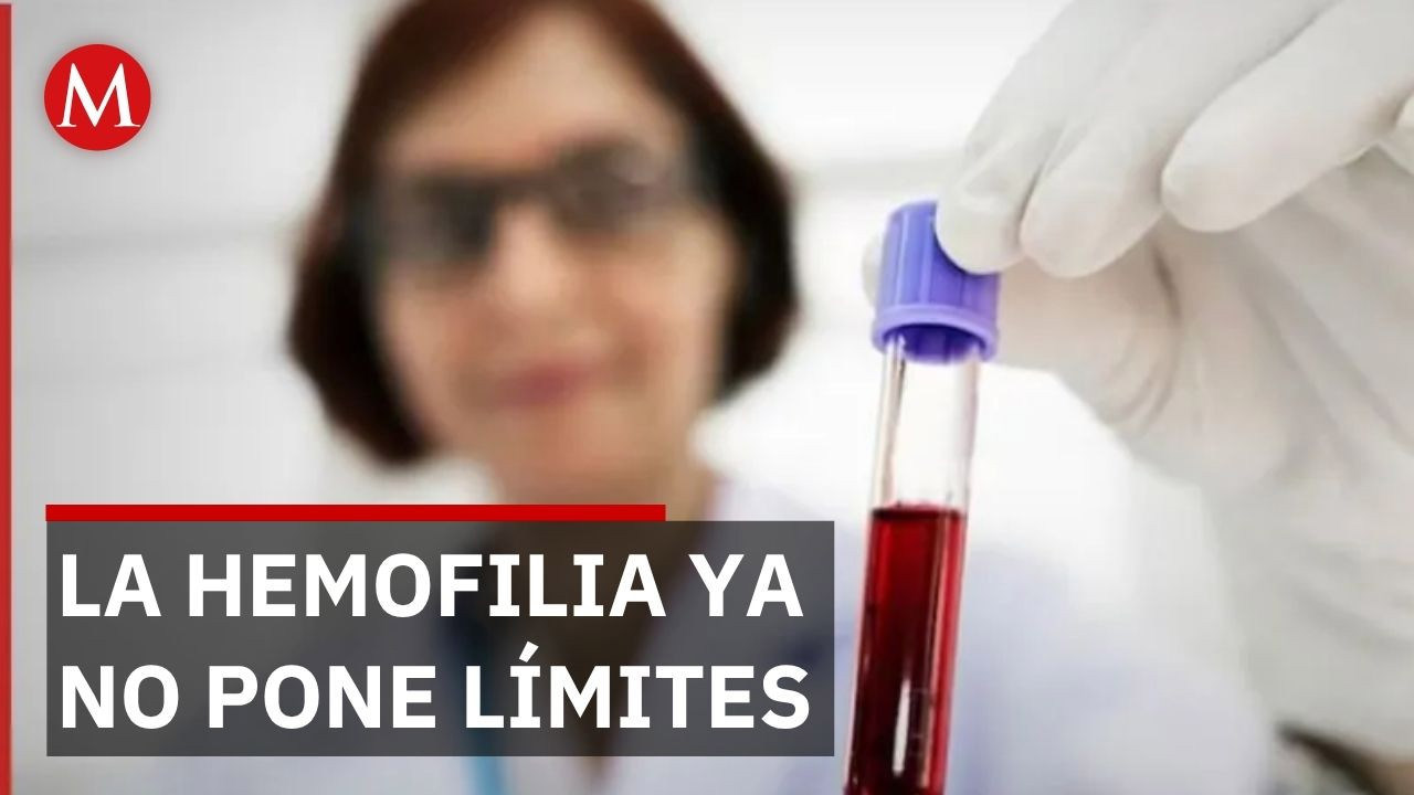 heminegligencia causas y tratamientos que sorprenden