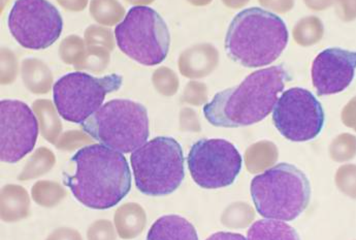 LEUCOCITOS: Qué SON y por qué son CRUCIALES para tu SALUD 19 leucocitos que son y por que son cruciales para tu salud