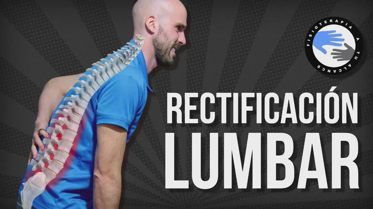 LORDOSIS LUMBAR: Qué es y por qué es IMPORTANTE 2 lordosis lumbar que es y por que es importante