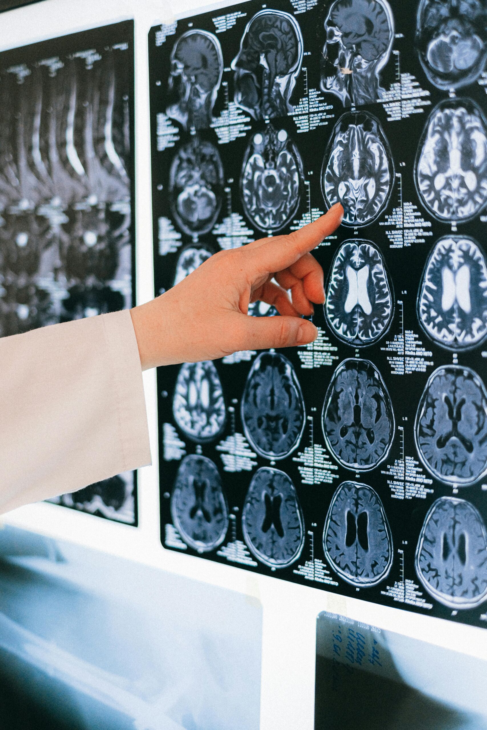 MMPI: Qué Revelan Realmente tus Resultados 2 mmpi que revelan realmente tus resultados