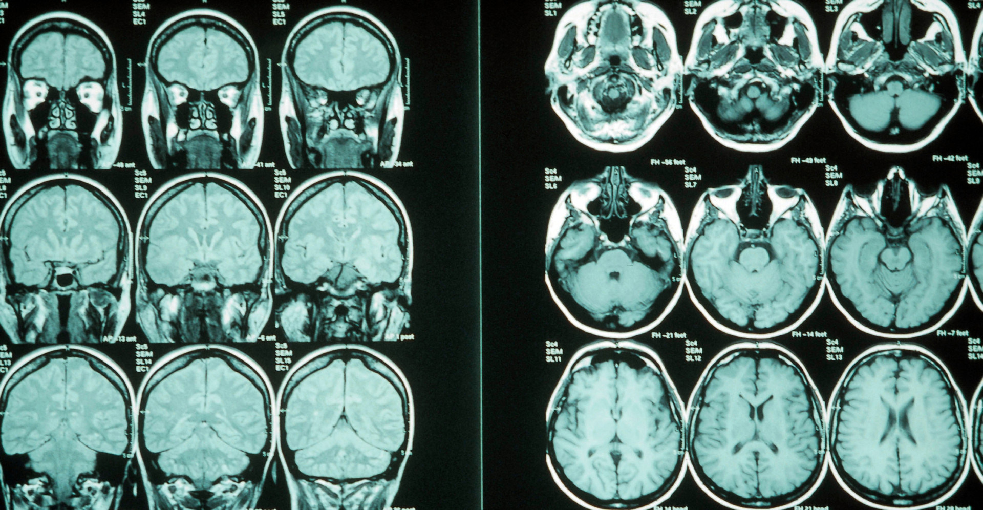 partes de un cerebro sabes que hace realmente