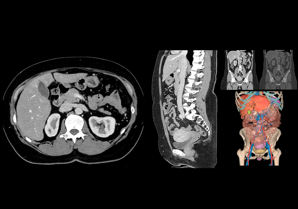 pelvis que es y por que es importante para tu salud