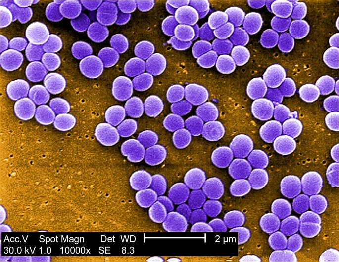 QUÉ SON LAS BACTERIAS Descubre sus TIPOS y ESTRUCTURA 2 que son las bacterias descubre sus tipos y estructura
