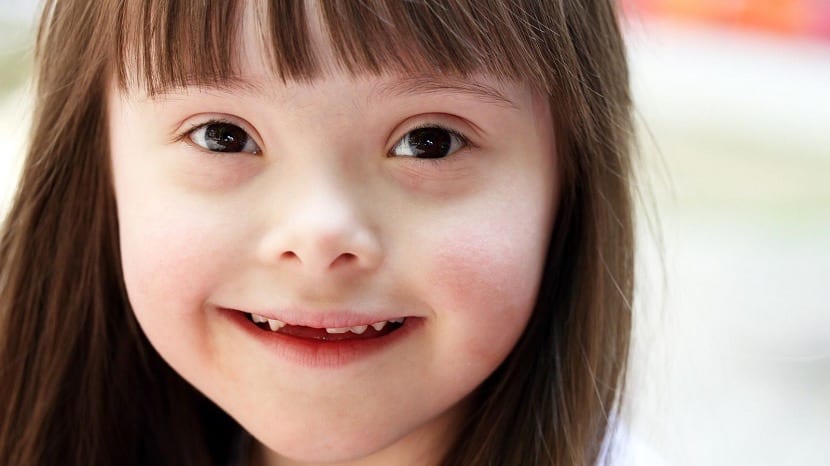 Tipos de Síndrome: DESCUBRE 15 ANOMALÍAS CROMOSÓMICAS 2 tipos de sindrome descubre 15 anomalias cromosomicas